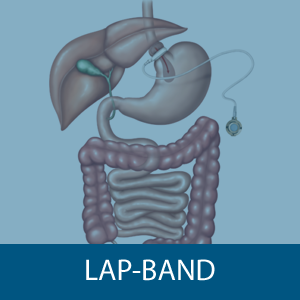 LAP-BAND