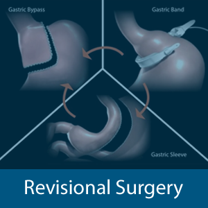 Revisional Surgery