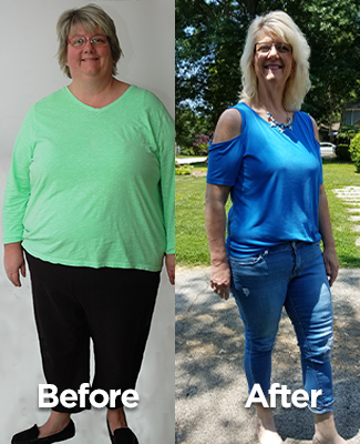 How Bariatric Surgery Changed Two Lives